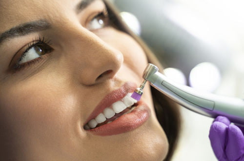 Dental hygienist polishing a patient's teeth during a professional dental cleaning