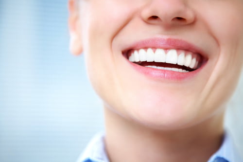 Bright white smile after custom teeth whitening in Barrie
