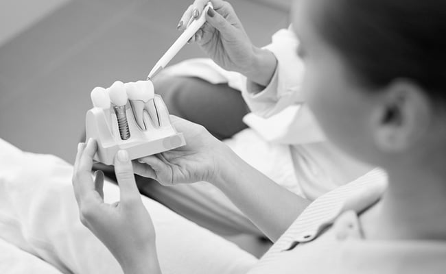 Dentist explaining the dental implant procedure to a patient during a consultation in Barrie