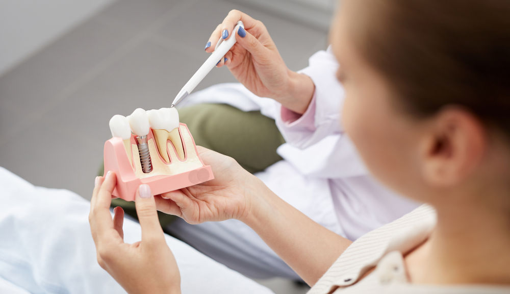 Dentist explaining the dental implant procedure and how dental implants work